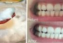 Převalování oleje v ústech léčí nejen ústní dutinu, ale i celý organismus