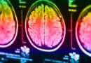 Vědci zjistili, že během dálkového léčení dochází v mozku příjemce k měřitelným změnám