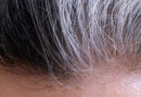 Vaše kštice si pamatuje stresující události, díky odpočinku mohou šedé vlasy získat zpět původní barvu