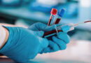 GENOCIDA: 94% očkovaných proti covidu má  podle italských odborníků a nové recenzované vědecké studie fatální změny v krvi, tzv. okluzi