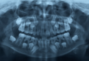 Skutečně mohou člověku narůst třetí zuby? Japonští vědci jsou o tom přesvědčeni