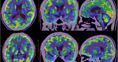 COVID injekce jako biologická zbraň s odloženým účinkem – čeká nás vlna prionových onemocnění