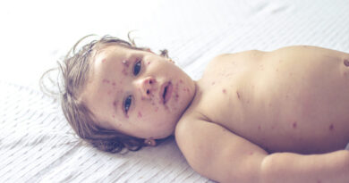 Za odbourání běžných dětských infekcí budou děti platit v dospělosti