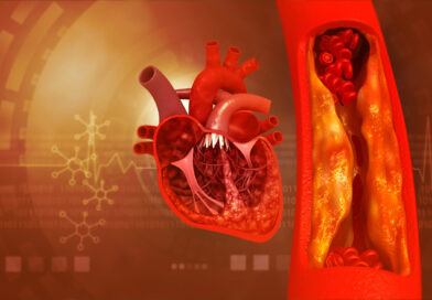Jak a proč správně užívat vitamin K2 Jak a proč správně užívat vitamin K2