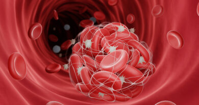 Jediná dávka nattokinázy skutečně rozpouští sraženiny