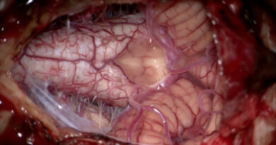 DECENTRALIZOVANÁ MEDICÍNA #103: VYČERPÁNÍ LIDSKÉHO VAGU