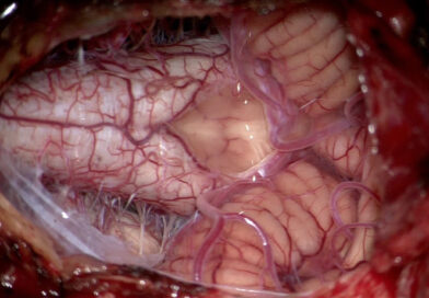 DECENTRALIZOVANÁ MEDICÍNA #103: VYČERPÁNÍ LIDSKÉHO VAGU